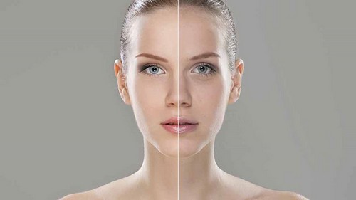 داشتن پوستی جوان بدون بوتاکس