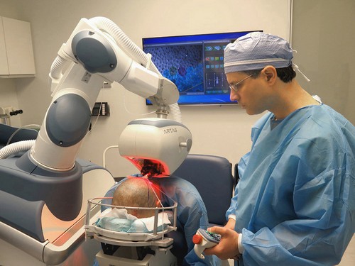 نکات بسیار مهم درباره کاشت موی طبیعی