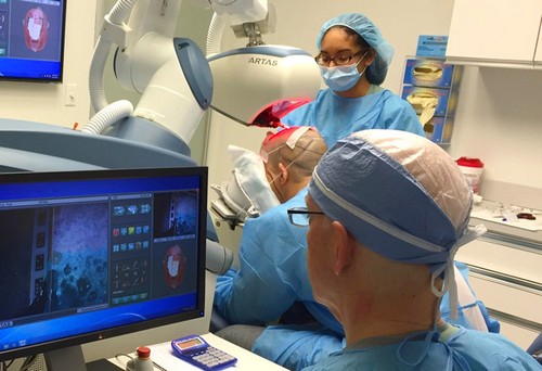 نکات بسیار مهم درباره کاشت موی طبیعی