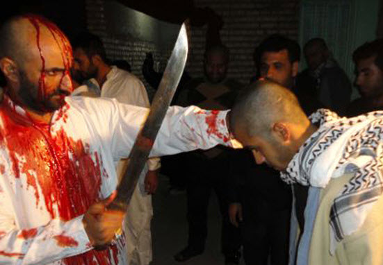 قمه زنی چه عواقب خطرناکی برای فرد دارد؟