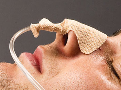 انسداد روده چیست و چگونه قابل درمان است؟