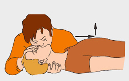 آموزش تنفس مصنوعی تصویری دهان به دهان و بینی