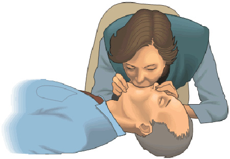 آموزش تنفس مصنوعی تصویری دهان به دهان و بینی