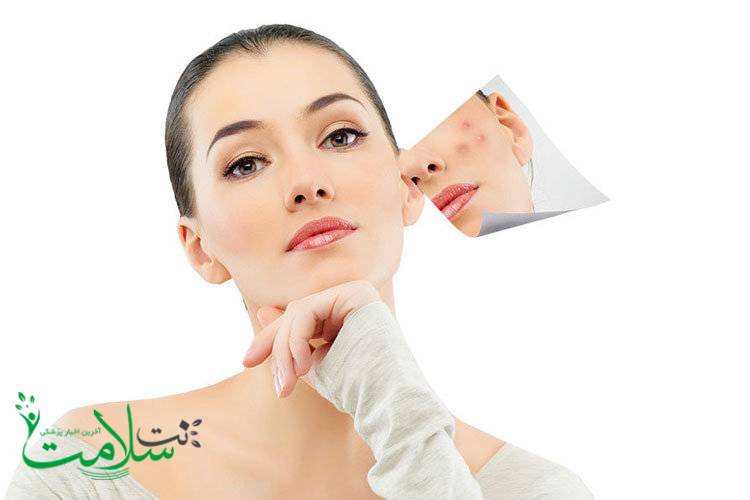از بین بردن جای زخم با چند روش خانگی