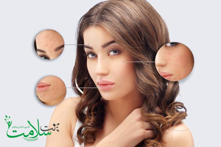 از بین بردن جای زخم با چند روش خانگی