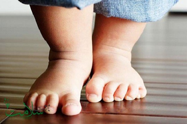 راه رفتن غیرطبیعی