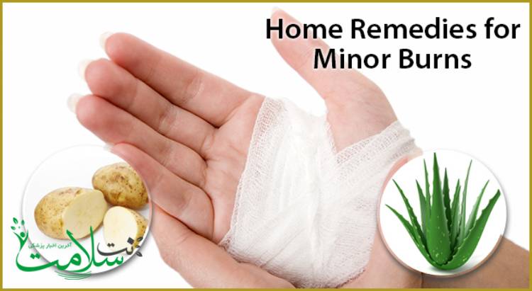 درمان سوختگی های سطحی