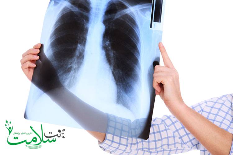 مشکلات تیروئید 