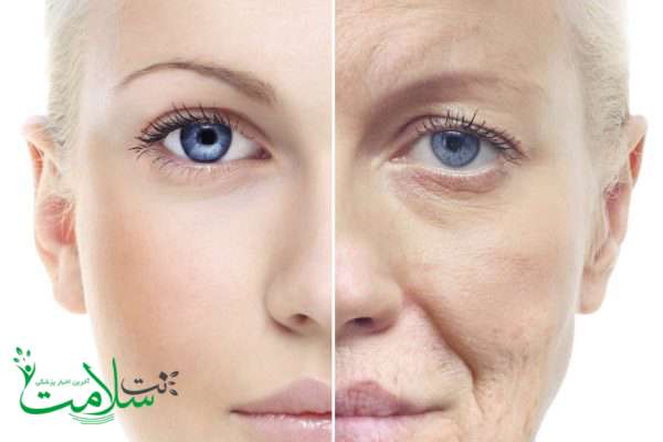 پیری پوست می ش پیری پوست می ش