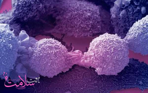 نشانه های سرطان پانکراس نشانه های سرطان پانکراس