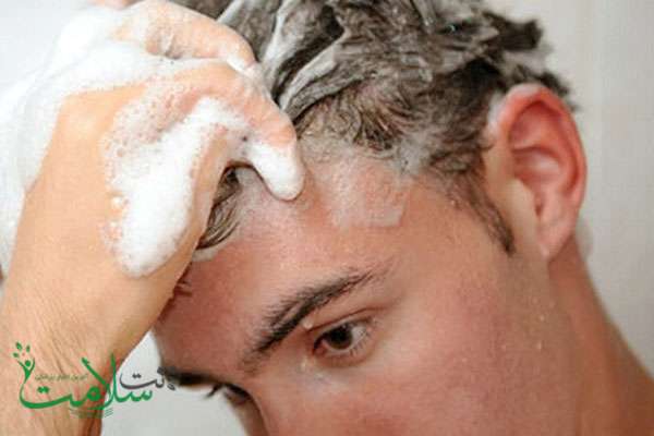 آکنه پوست سر