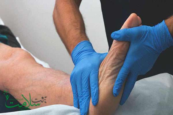 شکستگی جونز