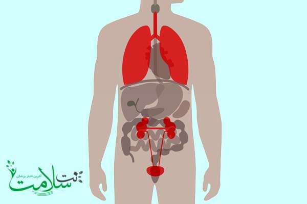 سلامت مثانه سلامت مثانه