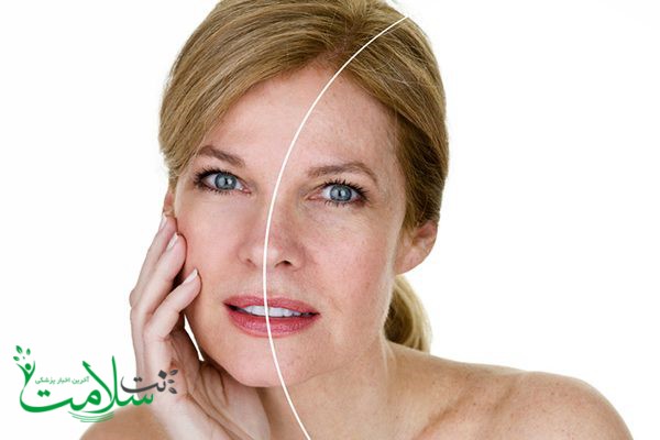پیری زودرس پوست پیری زودرس پوست